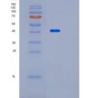 人Paralemmin蛋白(PALM)重组蛋白