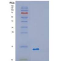 人OXLD1重组蛋白