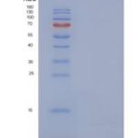 人NUP62CL重组蛋白