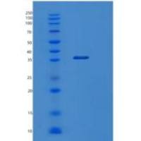 人旋光蛋白(OPTC)重组蛋白