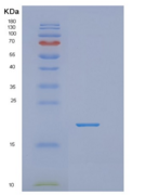 人NUDT2重组蛋白