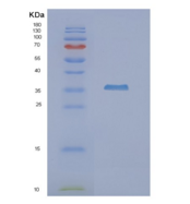 人NUDT9重组蛋白