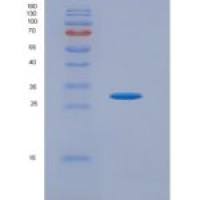 人血小板衍生生长因子受体α(PDGFRa)重组蛋白