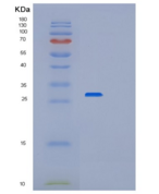 人过氧化还原酶6(PRDX6)重组蛋白