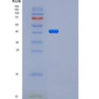 人PARP2重组蛋白