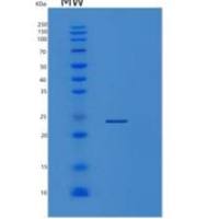 人类粘蛋白2(ORM2)重组蛋白