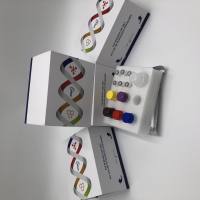 大鼠血管紧张素I(ANG I)ELISA试剂盒 /大鼠血管紧张素I(ANG I)ELISA试剂盒 