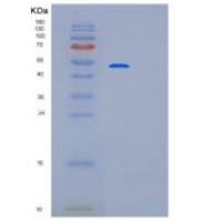 人帕金森氏病蛋白2(PARK2)重组蛋白