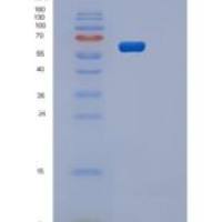 人丝氨酸/苏氨酸蛋白激酶OSR1(OXSR1)重组蛋白