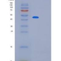 人PAICS重组蛋白