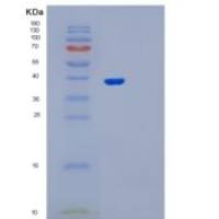 人OSGEP重组蛋白