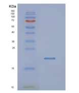 人NUDT4重组蛋白