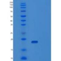 人PDZD11重组蛋白