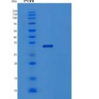 人破骨细胞关联受体(OSCAR)重组蛋白