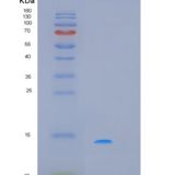 人细胞程序性死亡蛋白5(PDCD5)重组蛋白