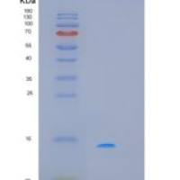 人细胞程序性死亡蛋白5(PDCD5)重组蛋白