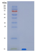 人PET117重组蛋白