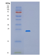 人细胞程序性死亡蛋白6(PDCD6)重组蛋白