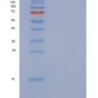 人甲状旁腺素（Parathyroid Hormone）重组蛋白