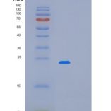 人细胞程序性死亡蛋白6(PDCD6)重组蛋白