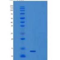 人平足蛋白(PDPN)重组蛋白