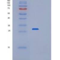 人过氧化还原酶6(PRDX6)重组蛋白