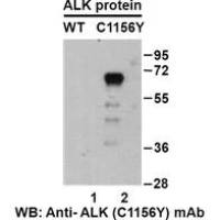 ALK(C1156Y)
