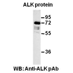 ALK Polyclonal Antibody