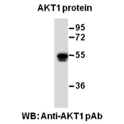AKT1 Polyclonal Antibody