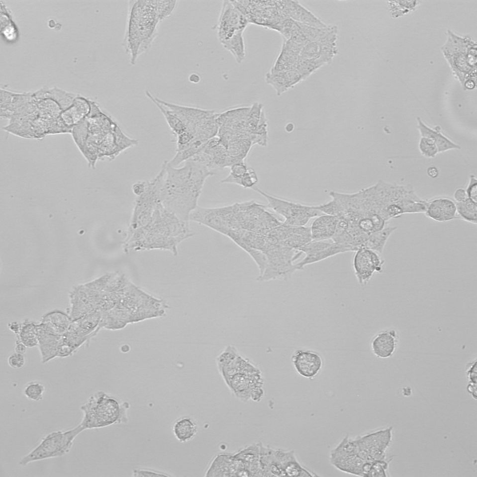 SK-N-FI 人神经母细胞瘤细胞