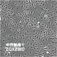 人脐静脉内皮细胞HUVEC-可提供伦理（细胞+500ml专培套装）