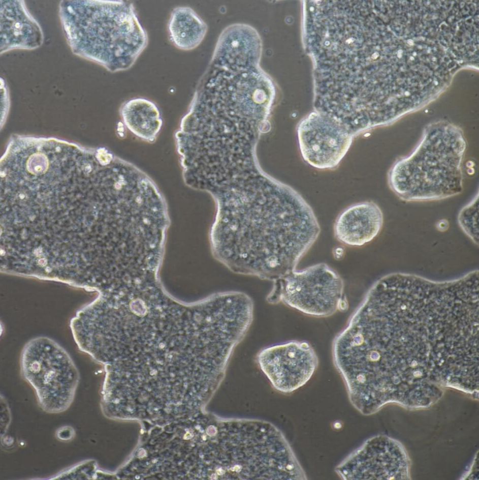 NCI-N87+luc 人胃癌细胞荧光素酶标记  镜像绮点（Cellverse）