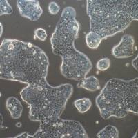 NCI-N87+luc |NCI-N87/luc细胞|NCI-N87+luc细胞|NCI-N87