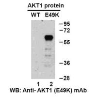 AKT1(E49K)