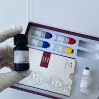 人抗肝肾微粒体抗体(Anti-LKM-1 IgG)ELISA试剂盒