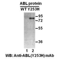 Abl(Y253H)