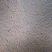 人脂肪间充质干细胞