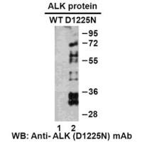 ALK (D1225N)