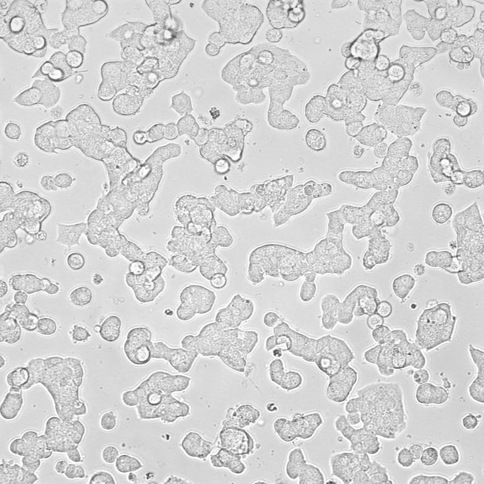 MIN-6 小鼠胰岛素瘤胰岛β细胞