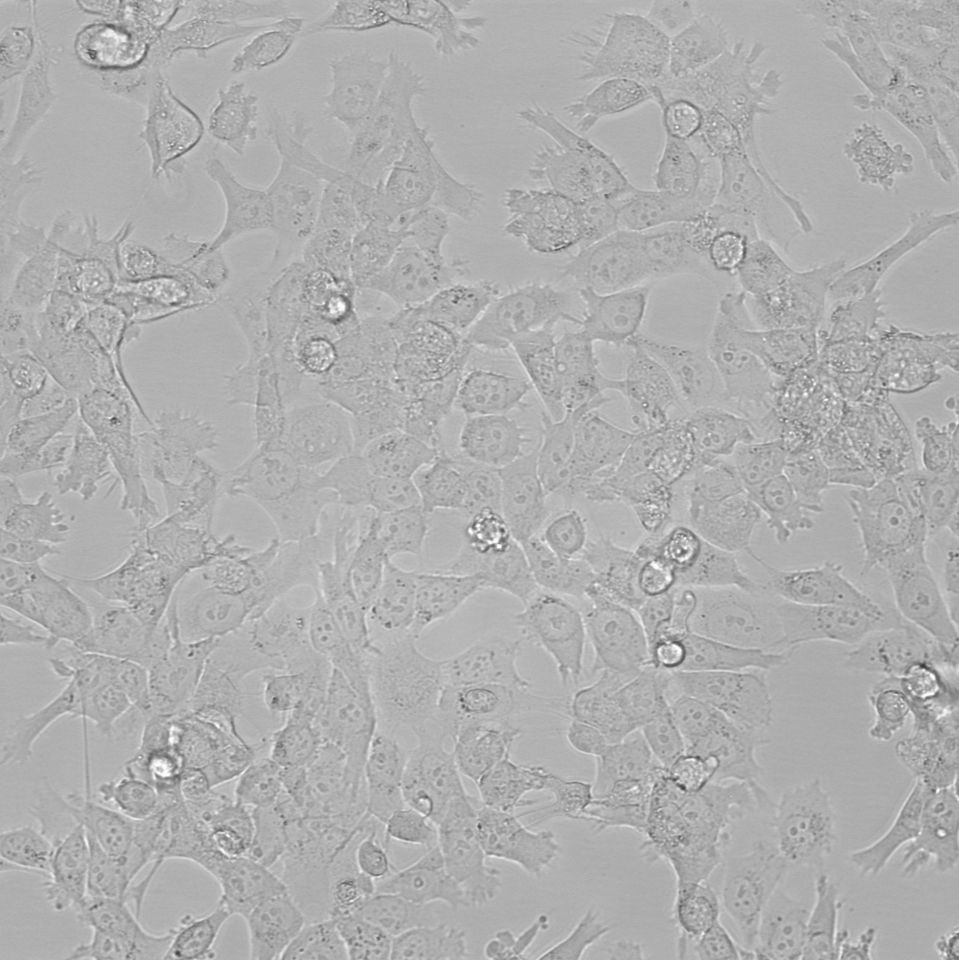 JMSU1 人膀胱癌细胞