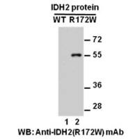 IDH2 (R172W)