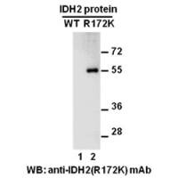 IDH2(R172K)