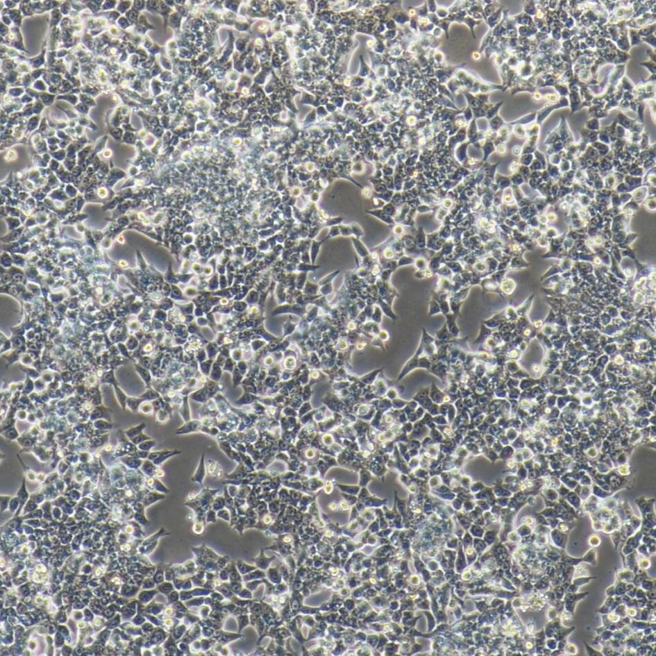 HCT116+luc 人结肠癌细胞 荧光素酶标记 镜像绮点（Cellverse）