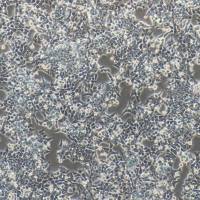 HCT116+luc 人结肠癌细胞/荧光素酶标记