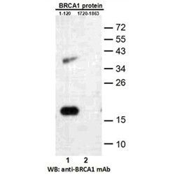 BRCA1(1-120)