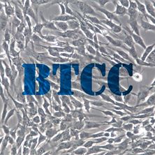 HCMEC/D3永生化人脑微血管内皮细胞