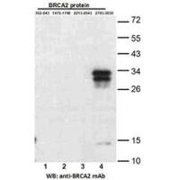 BRCA2 (2793-3030)