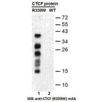 CTCF (R339W)