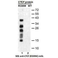 CTCF (R339W)