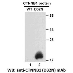 CTNNB1(D32N)